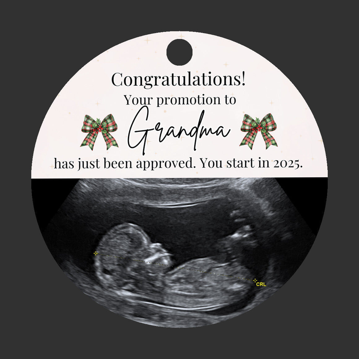 Custom Sonogram Ornament – Fun Pregnancy Announcement