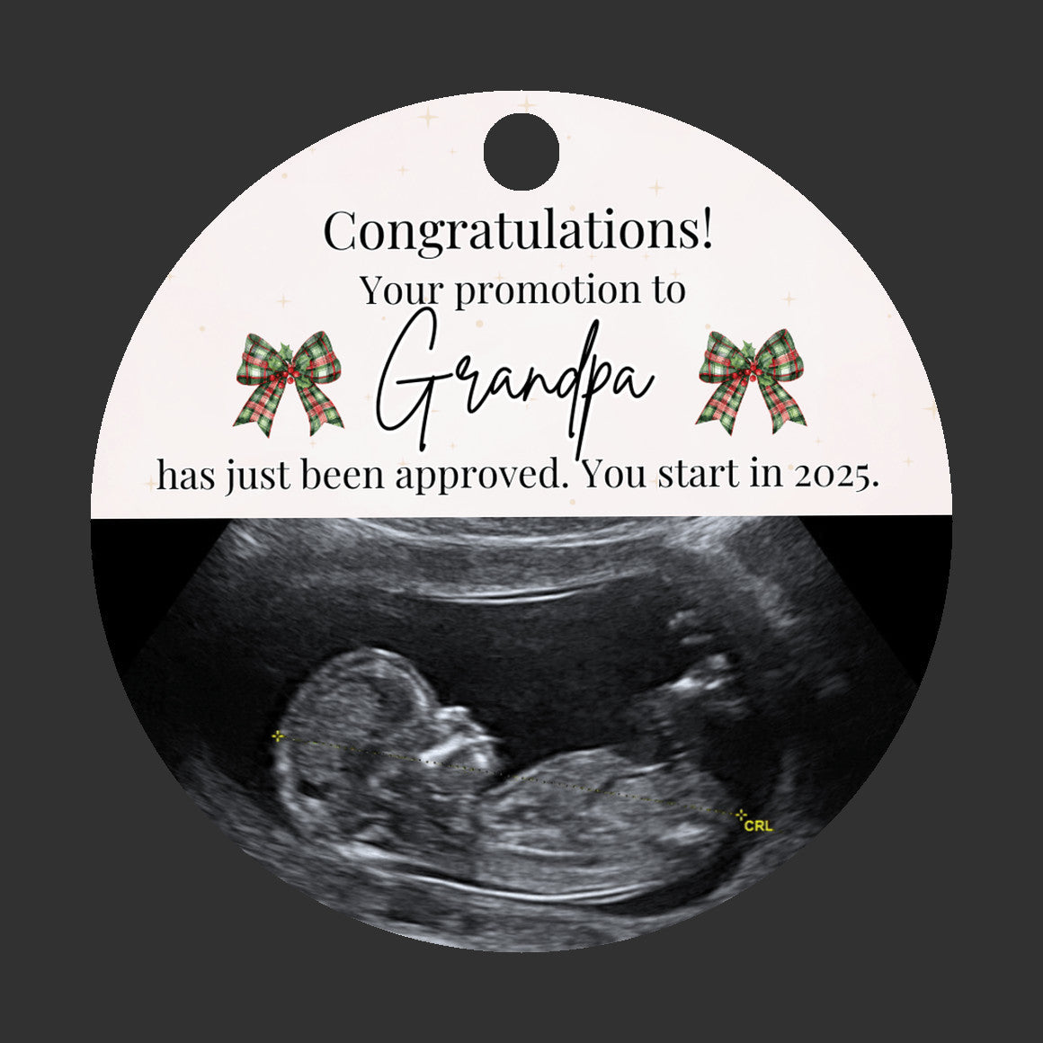 Custom Sonogram Ornament – Fun Pregnancy Announcement