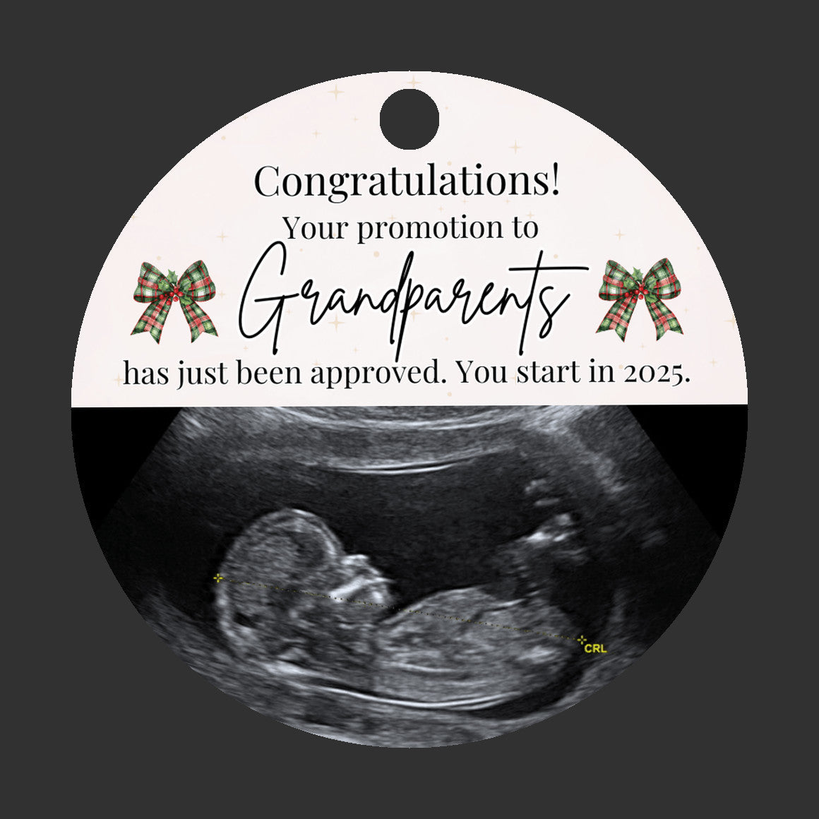 Custom Sonogram Ornament – Fun Pregnancy Announcement